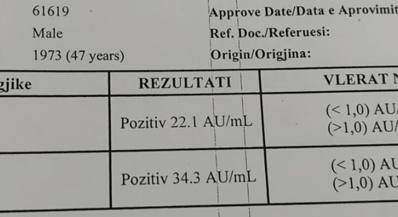 Interpretimi i testeve serologjike per Covid-19