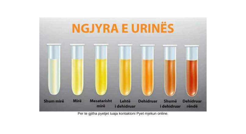 NGJYRAT NORMALE DHE JONORMALE TE URINES , KUR DUHET TE SHQETESOHEMI ?